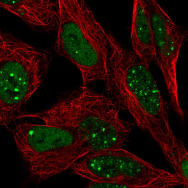 Anti-BCL9