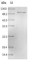 Nucleoprotein (N), Lassa virus, recombinant