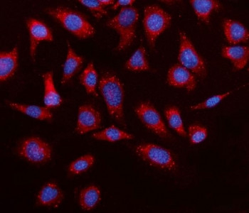 Anti-Elovl4