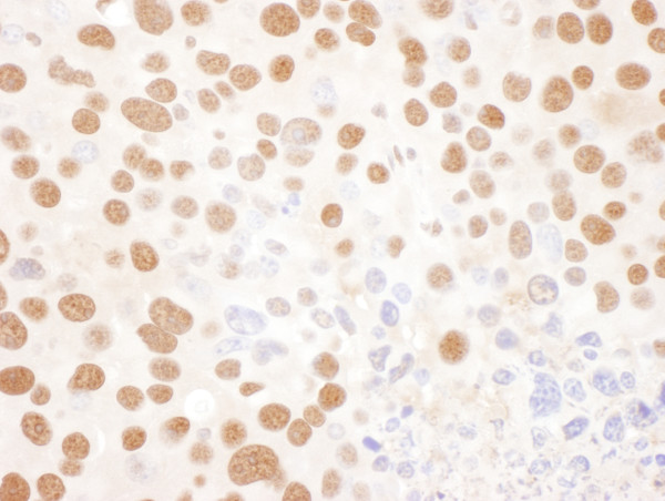 Anti-NF45