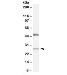 Anti-BNIP1