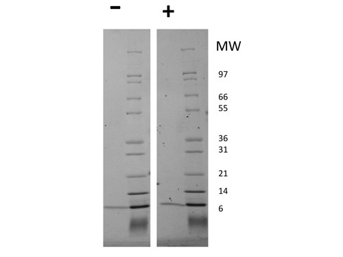 Neuregulin 1-beta