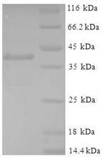 Glutathione S-transferase P 1 (Gstp1), mouse, recombinant