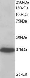 Anti-PDLIM4 / RIL, C-terminal