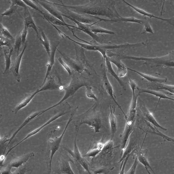 Wilms8 Cells