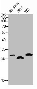 Anti-Phospho-KCNIP3 (S63)