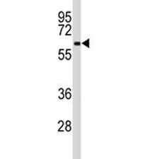 Anti-BECN1, clone 117CT2.5.1.1