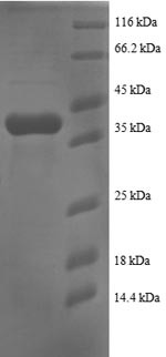 Small ribosomal subunit protein eS25 (RPS25), human, recombinant