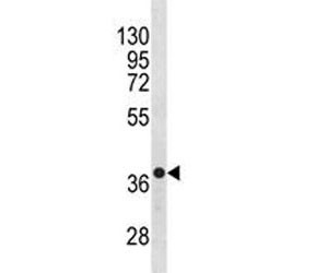 Anti-CXCR4