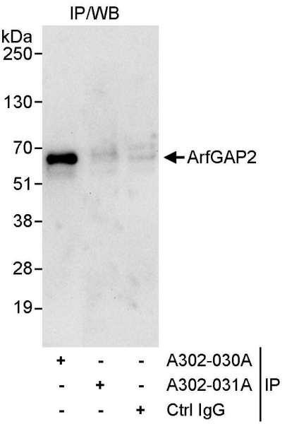 Anti-ArfGAP2