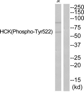 Anti-Phospho-HCK (Tyr521)