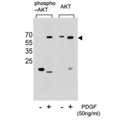 Anti-phospho-AKT (Ser473)