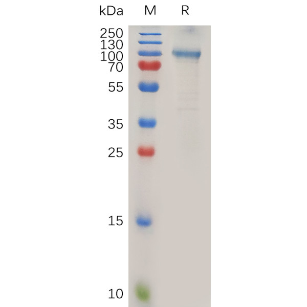 Human ADAM15 Protein, hFc Tag
