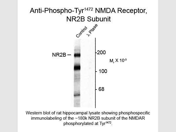 Anti-phospho-NMDA NR2B Subunit (Tyr1472)