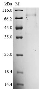 Mannan-binding lectin serine protease 2 (Masp2), mouse, recombinant