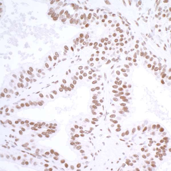 Anti-USP7/HAUSP Recombinant Monoclonal