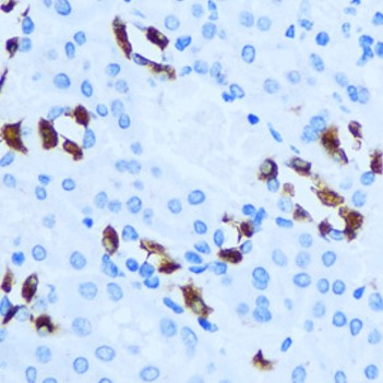 Anti-ATP6V1G3