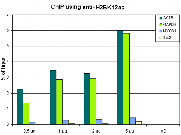 Anti-H2BK12ac