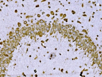 Anti-BRSK1 / Brain-selective kinase 1