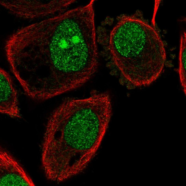 Anti-ATP6V1G1