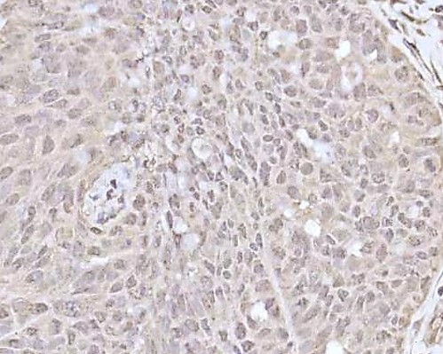Anti-Recoverin