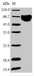 Band 3 anion transport protein (SLC4A1), partial, human, recombinant