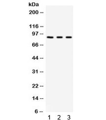 Anti-Complement Factor B / CFB