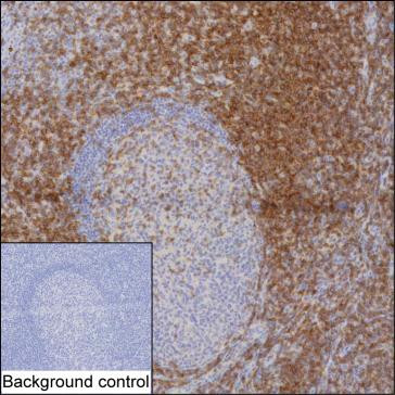 Anti-CD28