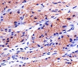 Anti-PHB1, clone 1215CT487.109.106