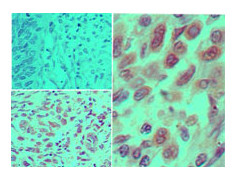 Anti-IKKalpha , clone 14A231