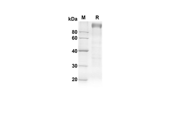 Recombinant Rat TLR4 Protein(Fc Tag)