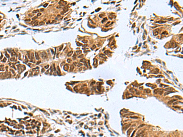 Anti-PDCD5