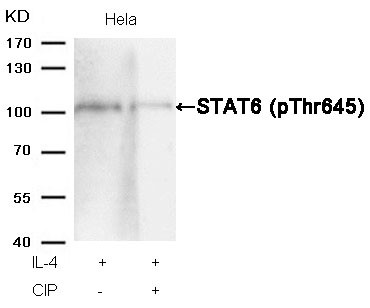Anti-phospho-STAT6 (Thr645)