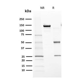 Anti-CYP1A1 / CYP1A2, clone MC1