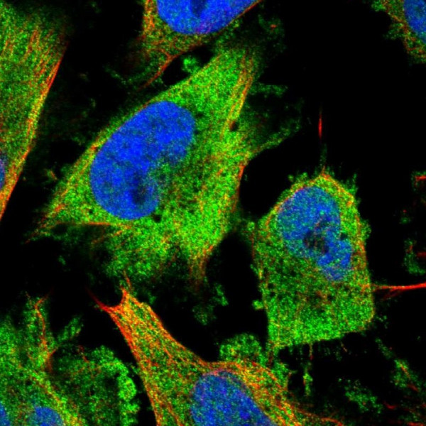 Anti-NUDCD3