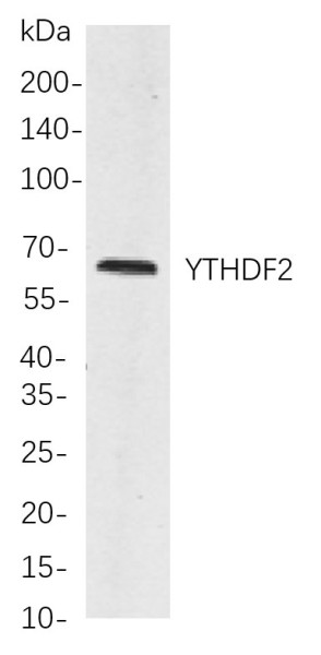 Anti-Recombinant YTHDF2, clone 9A2