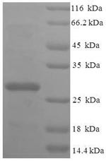 39S ribosomal protein L20, mitochondrial (MRPL20),partial, human, recombinant