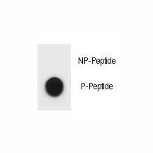 Anti-phospho-ULK1 (Ser467)