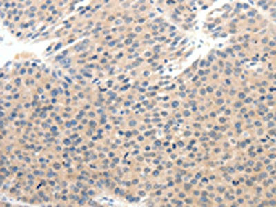Anti-SCN10A