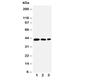 Anti-AQP2 / Aquaporin 2