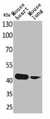 Anti-ACTC1