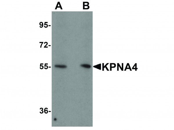 Anti-KPNA4
