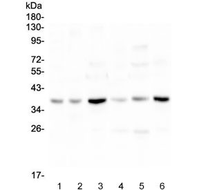 Anti-SIRT4