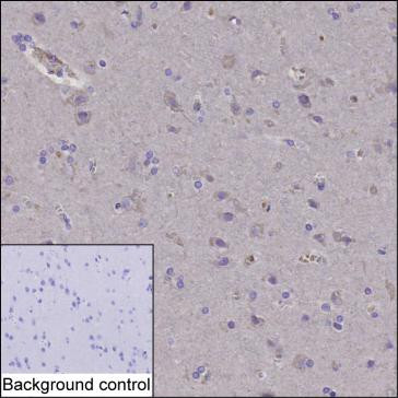Anti-HMGCR