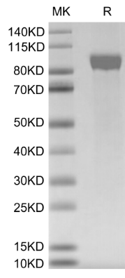 Her2, Avi &amp; His, Human