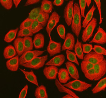 Anti-MX1 / MxA / Myxovirus resistance protein 1
