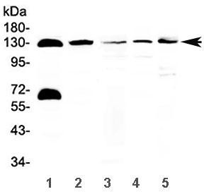 Anti-NEDD4-2 / NEDD4L