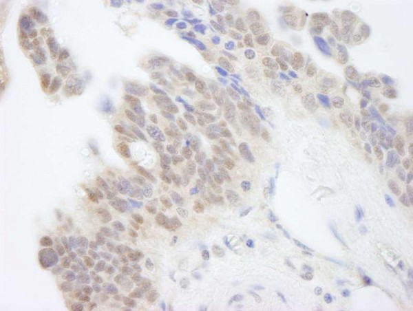 Anti-ABI1 (IHC)