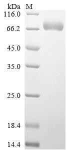 Sphingomyelin phosphodiesterase (SMPD1), human, recombinant