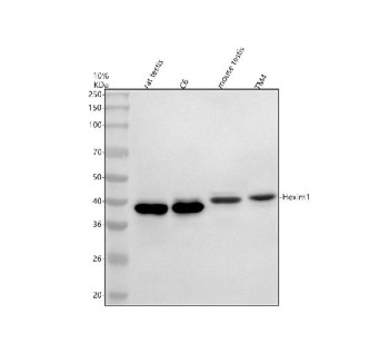 Anti-HEXIM2 / Hexamethylene bisacetamide-inducible protein 2